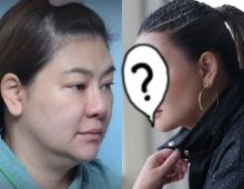 โอ๋ ภัคจีรา อัปเกรดหน้าใหม่ แก้จมูกรอบ30ปี สวยละมุนสุดๆ