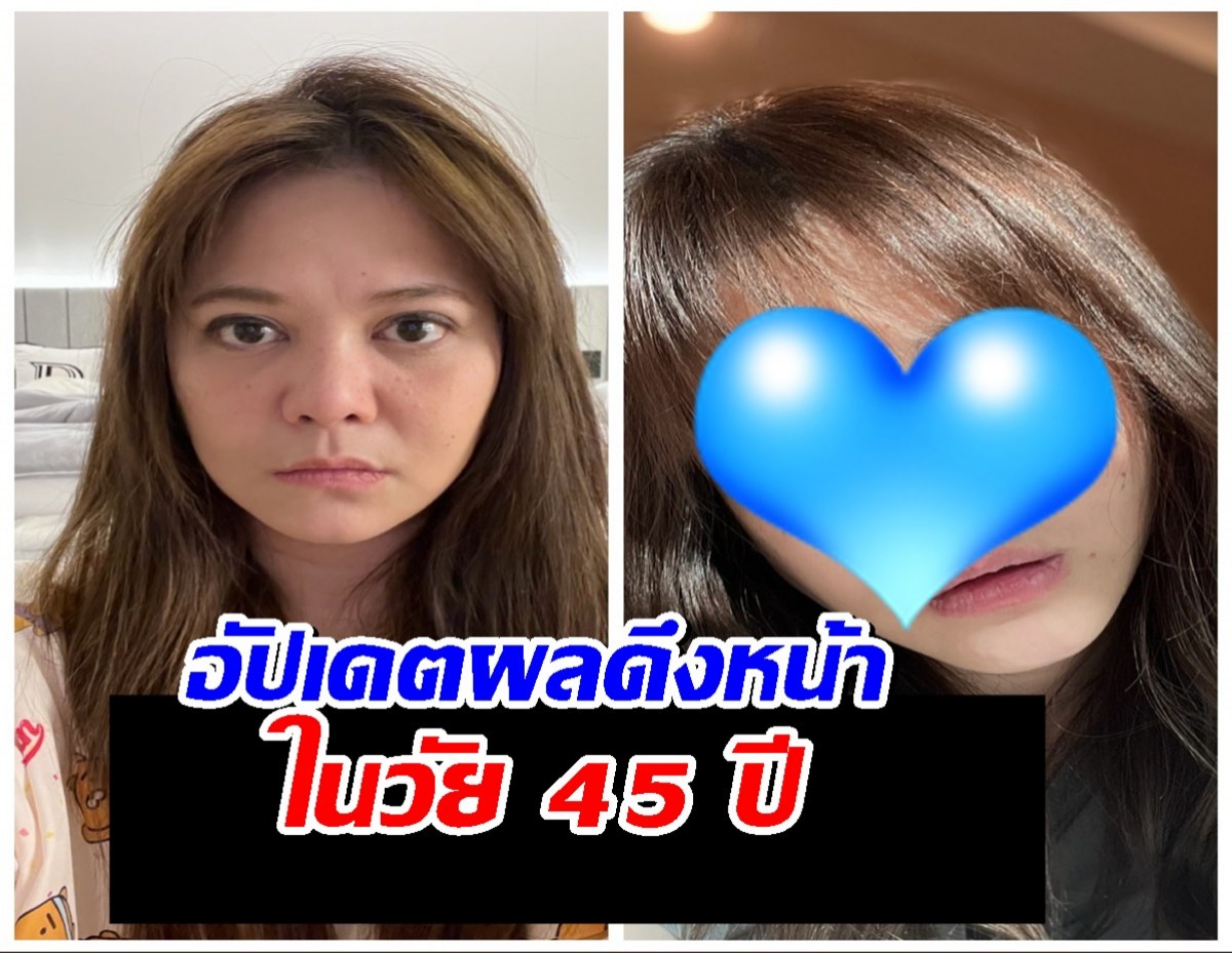 เปิดภาพ Before & After! พิมพ์ พิมพ์มาดา วัย 45 สวยสับหน้าเด็กกระชากวัย