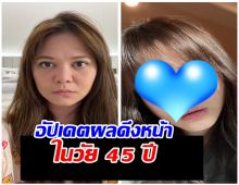 เปิดภาพ Before & After! พิมพ์ พิมพ์มาดา วัย 45 สวยสับหน้าเด็กกระชากวัย